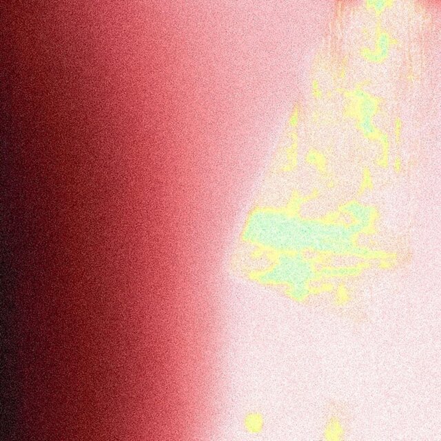 dopamine