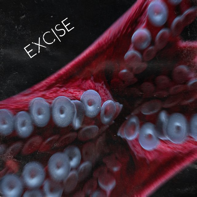 Excise