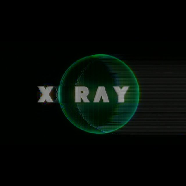 X-Ray