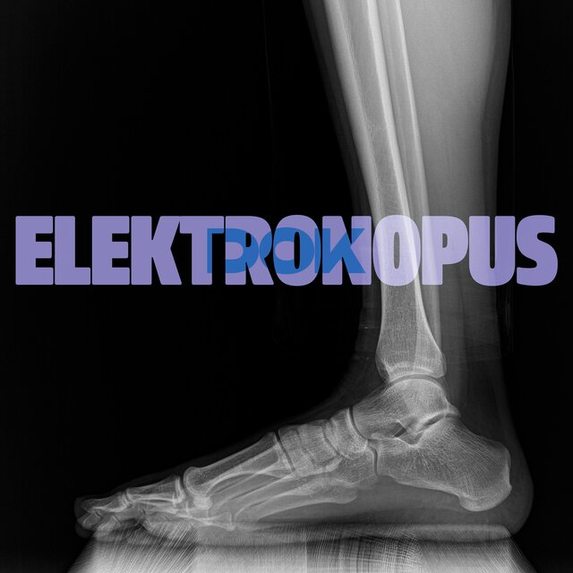 ELEKTRONOPUS