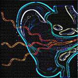 Tinnitus with Conflict