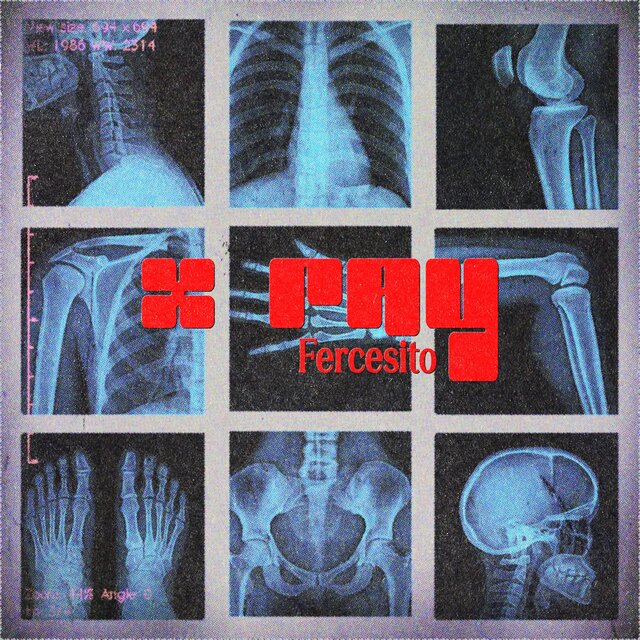 X RAY (feat. Camacho & Brus B)