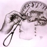 Lobotomy Dreams