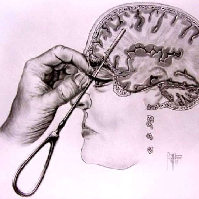 Lobotomy Dreams