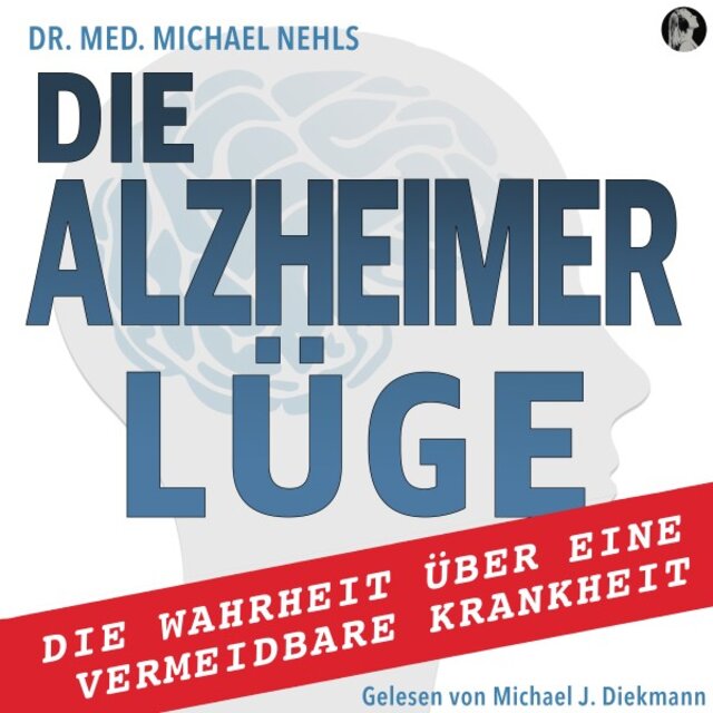 Die Alzheimer Lüge (Die Wahrheit über eine vermeidbare Krankheit)