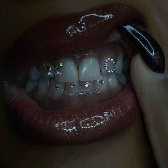 Diamonds