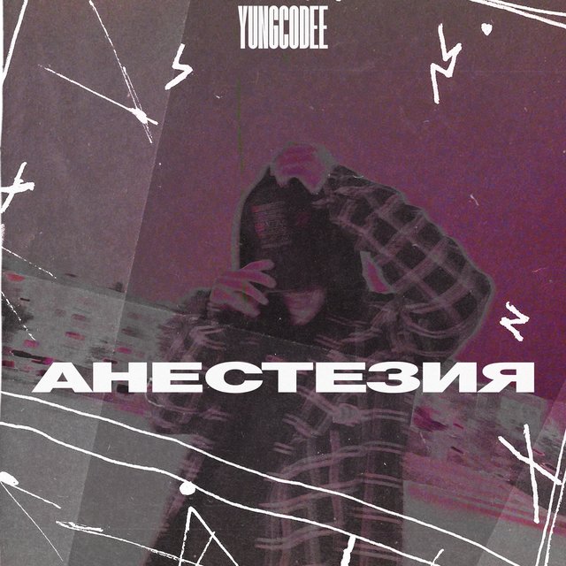 Анестезия