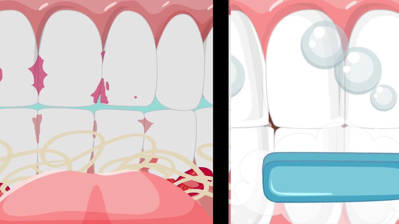 Brush Your Teeth
