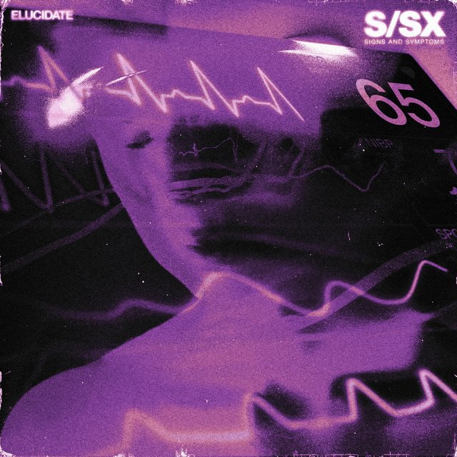 S/SX