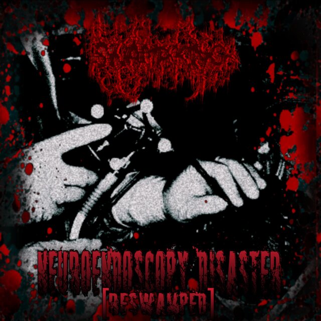 Neuroendoscopy Disaster (RESWAMPED)