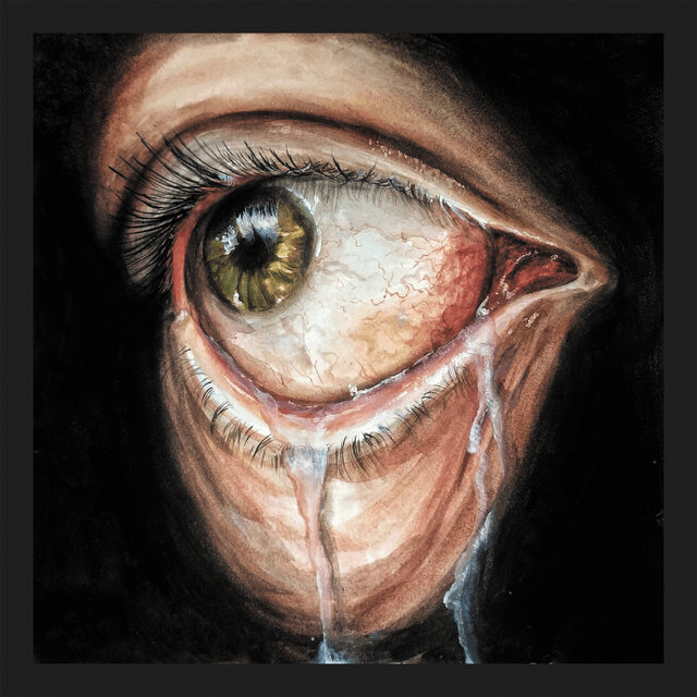 Lacrimal