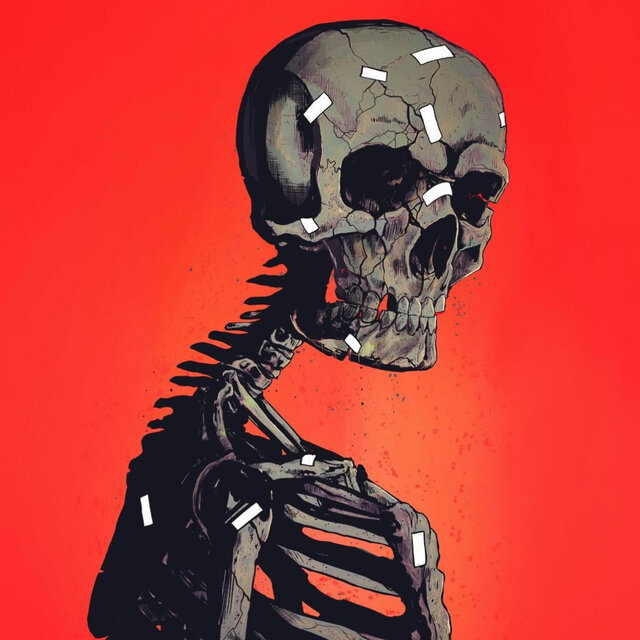 Pain Relief
