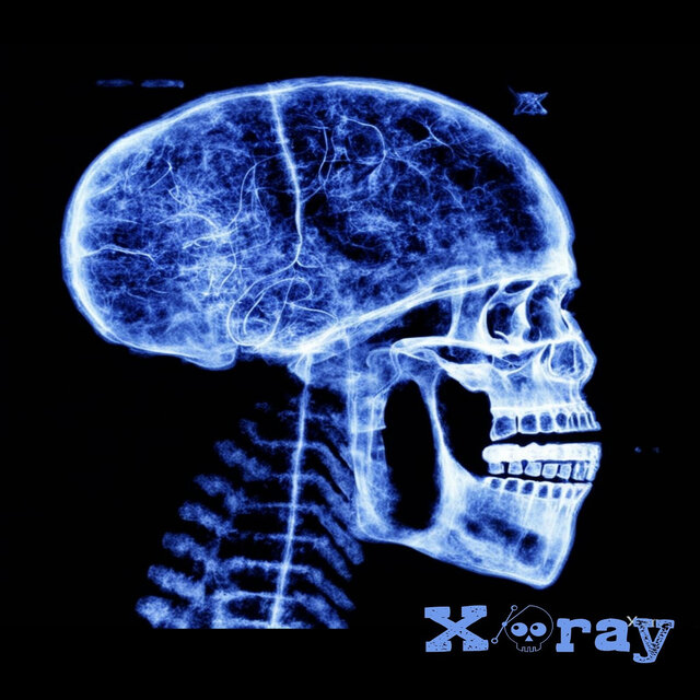 X-Ray