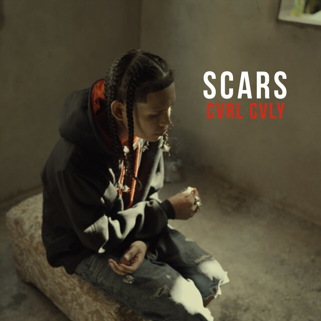 Scars