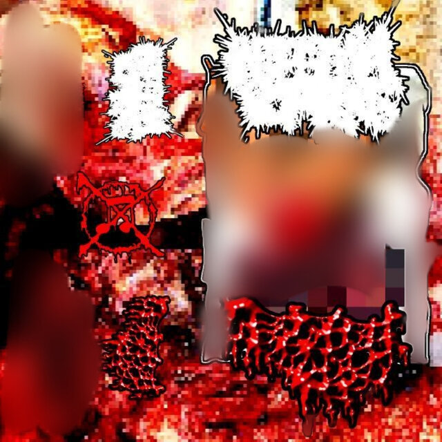 Split with Intestinal Vomiting