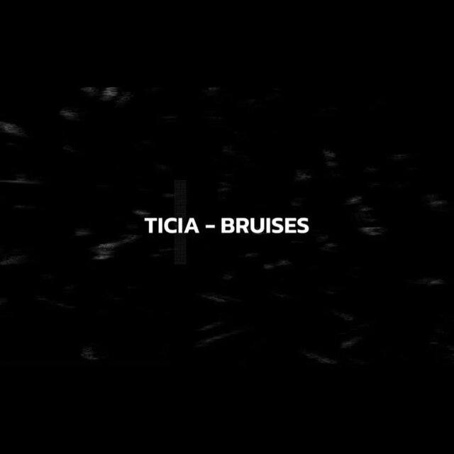 Bruises