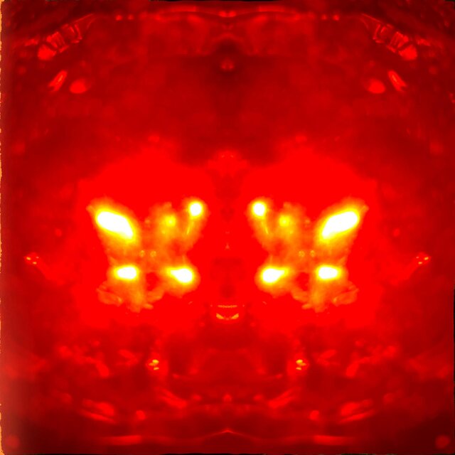 XX