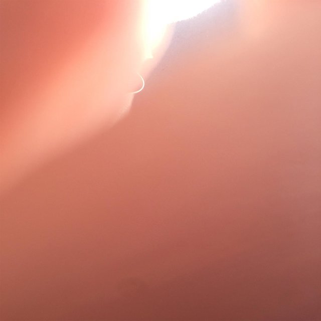 Open Sores
