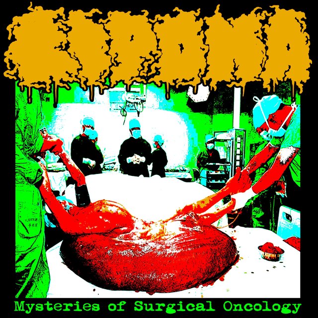 Mysteries of Surgical Oncology