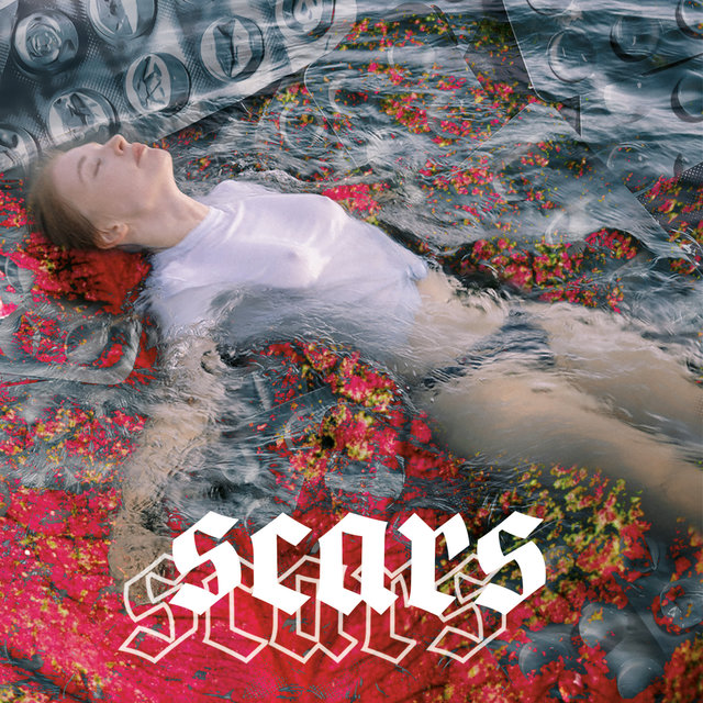 Scars