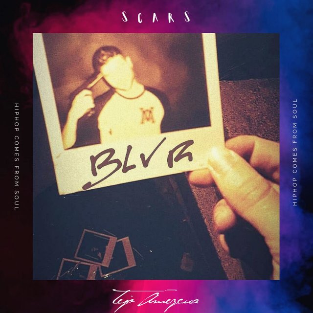 Scars