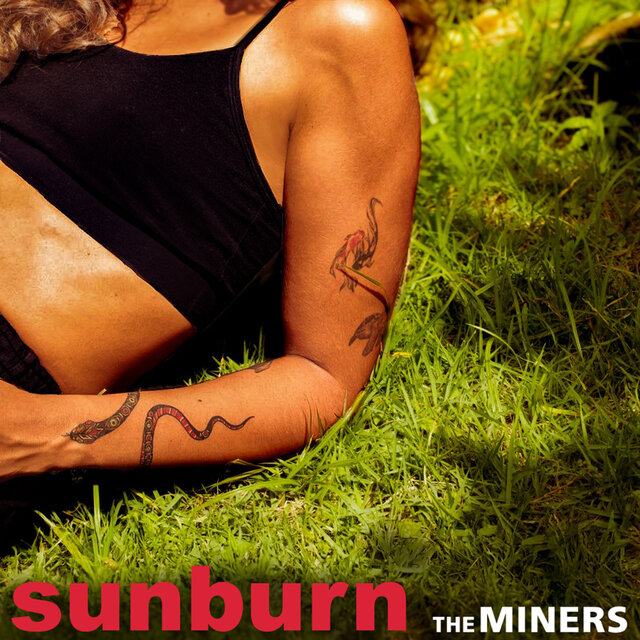 Sunburn