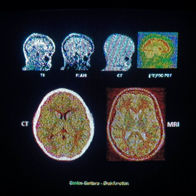 brain function