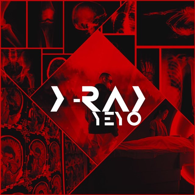 X-Ray