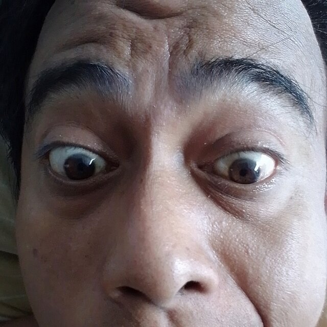 Dilarang sakit