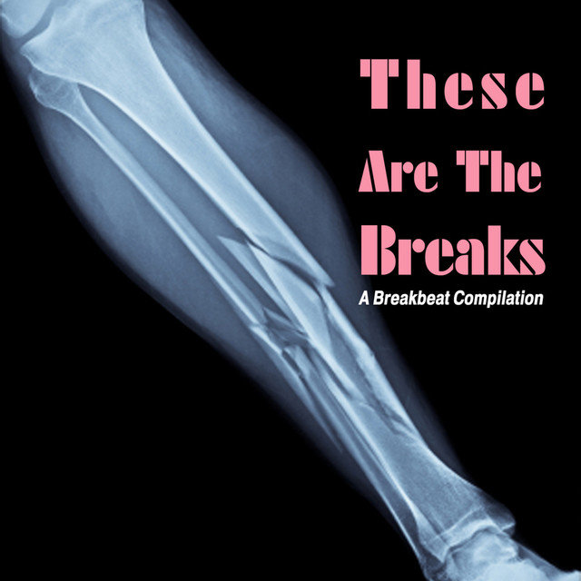 These Are The Breaks