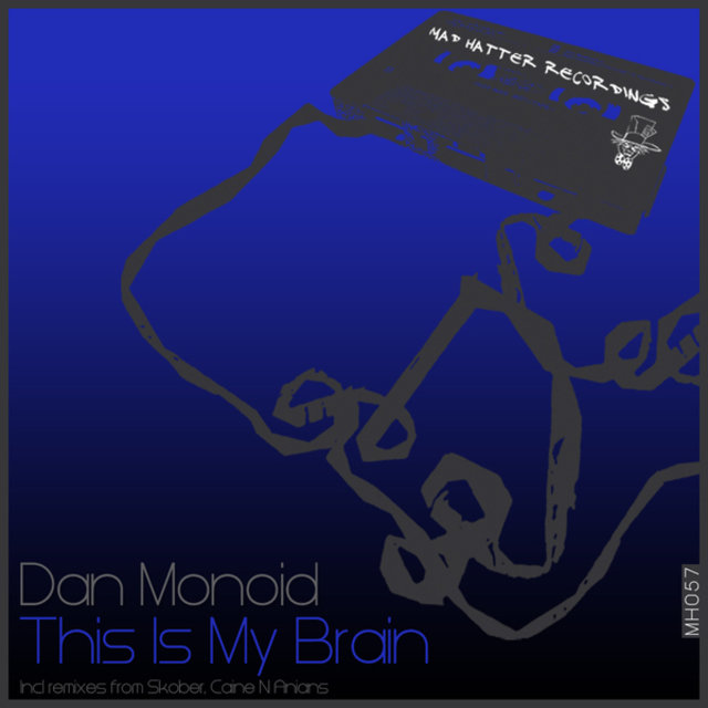 This Is My Brain