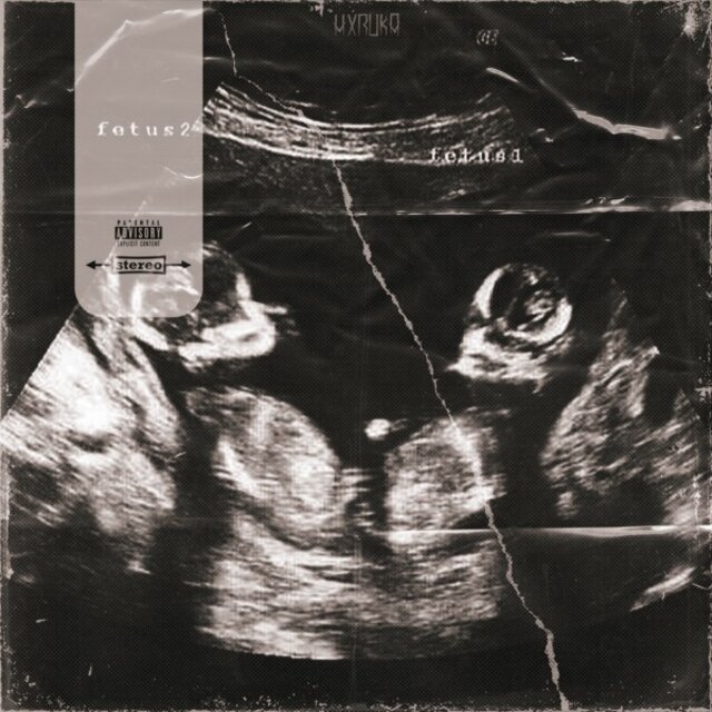 Fetus